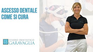 Ascesso dentale come si cura [upl. by Snell]