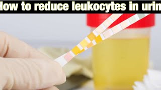 How to reduce leukocytes in urine [upl. by Nani158]