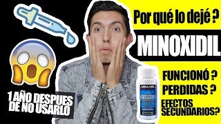 Por esto dejé el minoxidil 5 meses de tratamiento VICTOR CABALLERO [upl. by Sigvard]