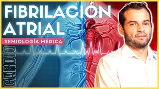 Semiología cardiovascular  Fibrilación atrial [upl. by Sarad]