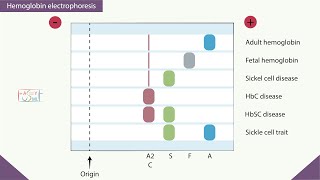 Hemoglobin electrophoresis [upl. by Min]