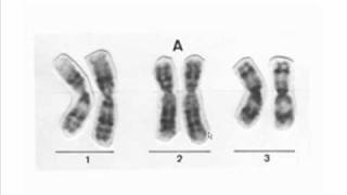 diferencias entre cromosomas [upl. by Torosian225]