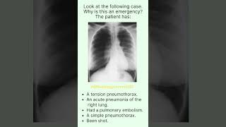 Radiology Q amp A radiologychannel007 [upl. by Niram392]