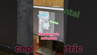 انواع الاشعة في طب الاسنان روتة x ray طبأسنان dentalinfection طباسنان [upl. by Fidellia607]