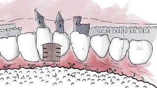 How Xylitol Works  Spry Dental Defense from Xlear [upl. by Briggs320]