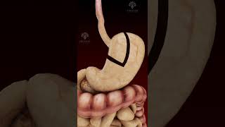 Gastric Bypass Laparoscopic Treatment shorts  creativelearning3d [upl. by Klarrisa]