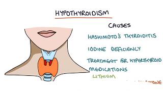 Hypothyroidism and Hashimotos Thyroiditis Visual Explanation for Students [upl. by Esojnauj338]