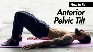 What is Anterior Pelvic Tilt amp How do I FIX Anterior Pelvic Tilt [upl. by Aicertap777]