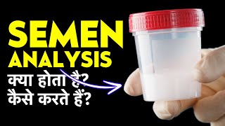 Semen Analysis Test Procedure amp Report in Hindi  Semen Analysis Kaise Hota Hai [upl. by Ralf85]