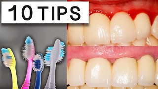 10 Tips To Reduce Swollen Gums At Home [upl. by Rinna]