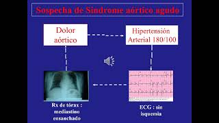 Sindrome aortico agudo Curso Superior de Emergencias  Lujan [upl. by Atirabrab]