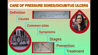 CARE OF PRESSURE SORE BED SORE  CAUSESPREVENTIONTREATMENT bakulsarkar [upl. by Aleuqahs]