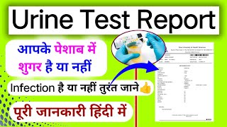 अपने पेशाब में शुगर का पता कैसे करे।।Urine report analysis।।Urine test report Sugar trace।। [upl. by Calida]