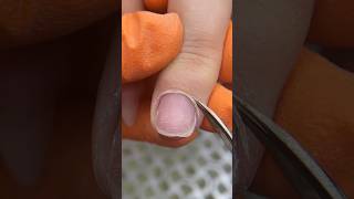 Cuticle Cutting😍 cuticlecare cuticle cuticles russianmanicure manicurarusa manicuretutorial [upl. by Calder]