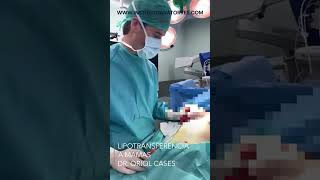 Lipotransferencia mamas Dr Oriol Cases  Instituto Dra Ana Torres Barcelona [upl. by Persian301]