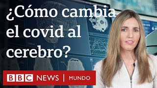 Cómo cambia el cerebro tras una infección por coronavirus aunque esta sea leve  BBC Mundo [upl. by Gathers]