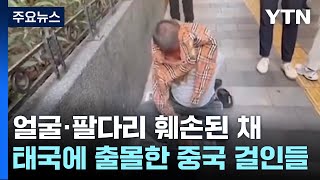 얼굴·팔다리 훼손 中 거지 태국 출몰quot인신매매 의심quot  YTN [upl. by Nollahs]