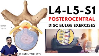 L4L5S1 posterocentral disc bulge exercises  L4L5 and L5S1 central disc bulge treatment in hindi [upl. by Gide261]