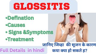 GlossitisDefinition causes signampSymptoms treatment Glossitis full Details tongue disorder [upl. by Hernando]