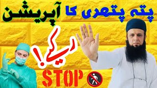 Gallstones Symptoms Treatment Urdu Hindi  پتہ کی پتھری کا علاج  Gallbladderstones [upl. by Nawoj]