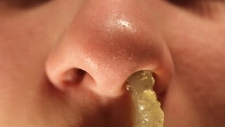 Huge Booger Removal [upl. by Hnad]