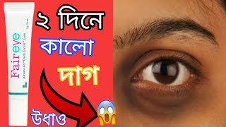 Fair eye cream  How to remove dark circles চোখের নিচের কালো দাগ দূর করুন মাএ 2 দিনে [upl. by Daniels]