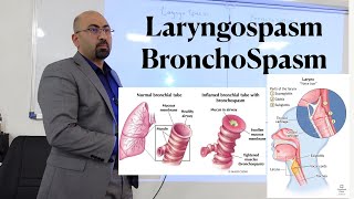 lec LaryngoSpasm amp Bronchospasm [upl. by Moss394]