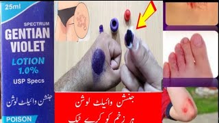 Gentian Violet Lotion kay faydahair zakham kaylia youtube youtubeshorts gentian gulmedical [upl. by Stevana817]