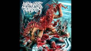 Abominable Putridity  The Anomalies Of Artificial Origin Remixed amp Remastered 2015 FULL ALBUM [upl. by Nagyam122]