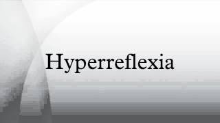 Hyperreflexia [upl. by Kylie]