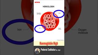 High Hemoglobin  🩸 hemoglobin hb அதிகபட்ச ஹீமோகுளோபின் என்ன  🩸❤️‼️ [upl. by Aynodal]