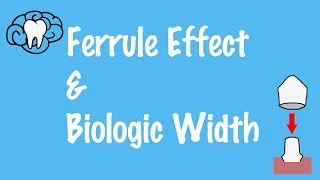 Ferrule Effect and Biologic Width [upl. by Neras]