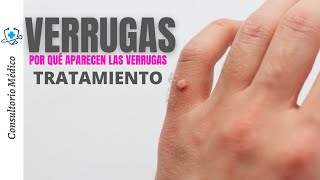 VERRUGAS  ¿Por qué aparecen las verrugas Tratamientos  👨‍⚕️ Consultorio Médico [upl. by Oiralih658]