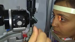 Laxmi Eye Education presents  Slit Lamp Examination [upl. by Ydissahc]