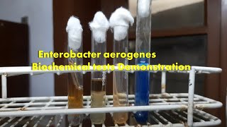 Enterobacter aerogenes Biochemical tests Demonstration [upl. by Noonberg]