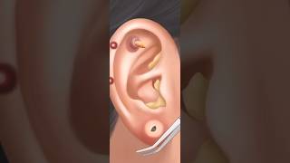 Ear Cleaning ASMR  ASMR  Ear wax removal asmr earcleaning [upl. by Ileray]