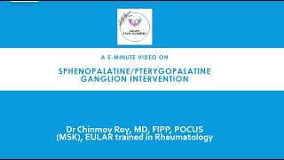 5Minute Video sphenopalatine ganglion block [upl. by Happ]