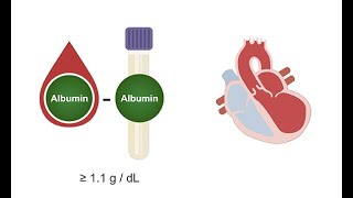 Analyzing the cell count and protein concentration in ascites [upl. by Mirak]