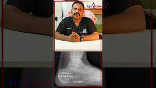 PSHYSIOTHERAPY TREAMENTS FOR HEEL PAIN  DR CLEMENT  ORTHO  PHYSIOTHERAPY  redtapetamil [upl. by Hermy]