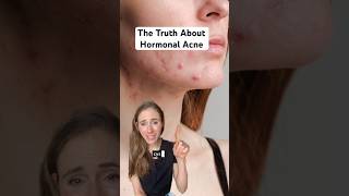 Hormonal Acne Is A Mixed Bag  Heres What You Need To Know dermatologist [upl. by Skippy491]