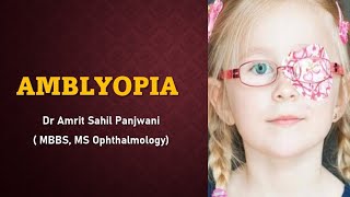 AMBLYOPIA  lazy eye EXPLAINED [upl. by Bodnar]