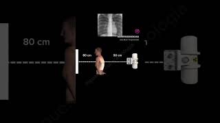 chest xray [upl. by Ibed]