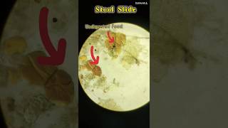 Stool examination shortsvideo youtube [upl. by Crichton]