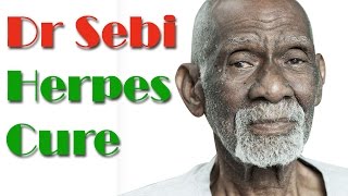 Dr Sebi Herpes Treatment  Natural Treatment For Herpes By Dr Sebi [upl. by Aisel]