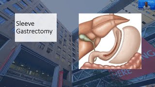 Weight Loss Surgery QampA Sleeve Gastrectomy [upl. by Acinomal789]