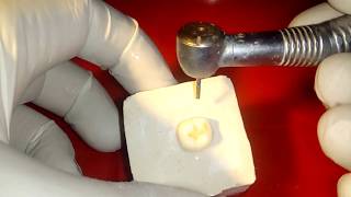 demonstration of conventional class 1 cavity preparation on mandibular molar for amalgam filling [upl. by Enirehtacyram455]