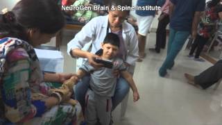 Treatment for Spastic Quadriplegia Cerebral Palsy [upl. by Koerner801]