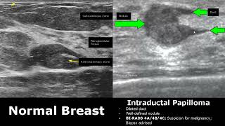 Anatomy and Physiology Help Chapter 4 Tissues [upl. by Emmaline]