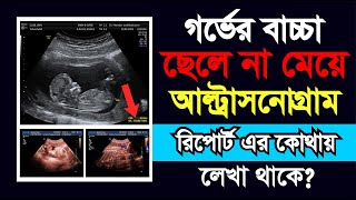 আল্ট্রাসনোগ্রাফি রিপোর্ট দেখে সহজে জেনে নিন গর্ভের সন্তান ছেলে না মেয়ে  ultrasonography report [upl. by Laon253]