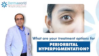 Periorbital Hyperpigmentation how to treat and how to cure  Dr Rohit Batra explains [upl. by Parnas601]